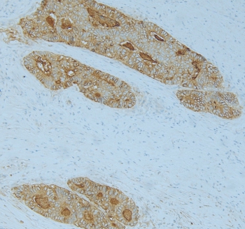 CEA protein(30-AC30)
